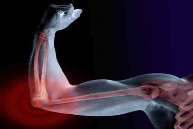 Keeps Bones Healthy